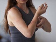 За клопов заплатит туроператор? Туристов покусали в отелях ОАЭ